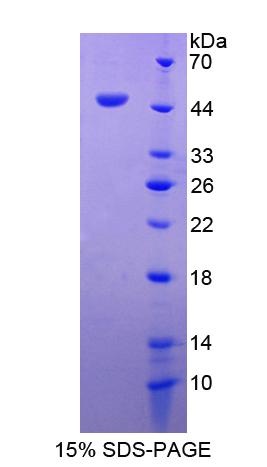 ADRM1 Protein - Recombinant  Adhesion Regulating Molecule 1 By SDS-PAGE