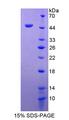 ADRM1 Protein - Recombinant  Adhesion Regulating Molecule 1 By SDS-PAGE