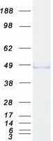 ADRM1 Protein - Purified recombinant protein ADRM1 was analyzed by SDS-PAGE gel and Coomassie Blue Staining