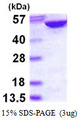 ADSL / Adenylosuccinate Lyase Protein