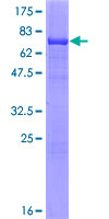ADSS Protein - 12.5% SDS-PAGE of human ADSS stained with Coomassie Blue