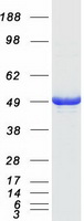 ADSS Protein - Purified recombinant protein ADSS was analyzed by SDS-PAGE gel and Coomassie Blue Staining