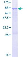 ADSSL1 Protein - 12.5% SDS-PAGE of human ADSSL1 stained with Coomassie Blue