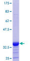 ADSSL1 Protein - 12.5% SDS-PAGE Stained with Coomassie Blue.