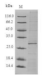 ADTRP / C6orf105 Protein - (Tris-Glycine gel) Discontinuous SDS-PAGE (reduced) with 5% enrichment gel and 15% separation gel.