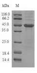 ADTRP / C6orf105 Protein - (Tris-Glycine gel) Discontinuous SDS-PAGE (reduced) with 5% enrichment gel and 15% separation gel.