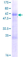 AEBP2 Protein - 12.5% SDS-PAGE of human AEBP2 stained with Coomassie Blue