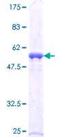 AES / Groucho Protein - 12.5% SDS-PAGE of human AES stained with Coomassie Blue
