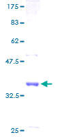 AF1Q / MLLT11 Protein - 12.5% SDS-PAGE of human AF1Q stained with Coomassie Blue