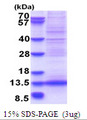AF1Q / MLLT11 Protein