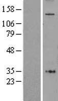 AF5Q31 / AFF4 Protein - Western validation with an anti-DDK antibody * L: Control HEK293 lysate R: Over-expression lysate