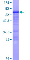 AF5Q31 / AFF4 Protein - 12.5% SDS-PAGE of human AFF4 stained with Coomassie Blue