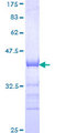 AF5Q31 / AFF4 Protein - 12.5% SDS-PAGE Stained with Coomassie Blue.