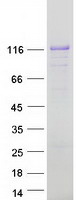 AFAP1L1 Protein - Purified recombinant protein AFAP1L1 was analyzed by SDS-PAGE gel and Coomassie Blue Staining