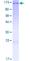 AFAP1L2 / XB130 Protein - 12.5% SDS-PAGE of human AFAP1L2 stained with Coomassie Blue