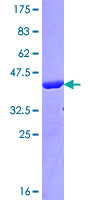 AFF2 / OX19 Protein - 12.5% SDS-PAGE Stained with Coomassie Blue.