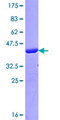 AFF2 / OX19 Protein - 12.5% SDS-PAGE Stained with Coomassie Blue.