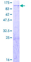 AFG3L2 Protein - 12.5% SDS-PAGE of human AFG3L2 stained with Coomassie Blue