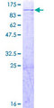 AFG3L2 Protein - 12.5% SDS-PAGE of human AFG3L2 stained with Coomassie Blue