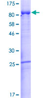AFM / Afamin Protein - 12.5% SDS-PAGE of human AFM stained with Coomassie Blue
