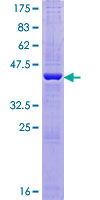 AG3 / AGR3 Protein - 12.5% SDS-PAGE of human BCMP11 stained with Coomassie Blue
