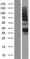 AGA / Aspartylglucosaminidase Protein - Western validation with an anti-DDK antibody * L: Control HEK293 lysate R: Over-expression lysate