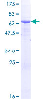 AGA / Aspartylglucosaminidase Protein - 12.5% SDS-PAGE of human AGA stained with Coomassie Blue