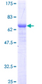 AGA / Aspartylglucosaminidase Protein - 12.5% SDS-PAGE of human AGA stained with Coomassie Blue