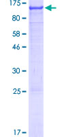 AGAP2 / PIKE Protein - 12.5% SDS-PAGE of human AGAP2 stained with Coomassie Blue