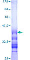 AGAP3 / CENTG3 / MRIP-1 Protein - 12.5% SDS-PAGE Stained with Coomassie Blue.