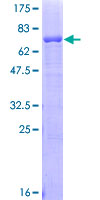AGER / RAGE Protein - 12.5% SDS-PAGE of human AGER stained with Coomassie Blue