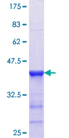 AGER / RAGE Protein - 12.5% SDS-PAGE Stained with Coomassie Blue.