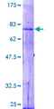 AGK Protein - 12.5% SDS-PAGE of human MULK stained with Coomassie Blue