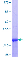 AGK Protein - 12.5% SDS-PAGE Stained with Coomassie Blue.