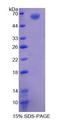 AGK Protein - Recombinant  Acylglycerol Kinase By SDS-PAGE