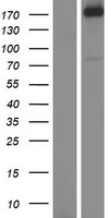AGL Protein - Western validation with an anti-DDK antibody * L: Control HEK293 lysate R: Over-expression lysate