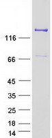 AGL Protein - Purified recombinant protein AGL was analyzed by SDS-PAGE gel and Coomassie Blue Staining