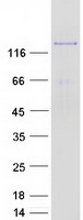 AGL Protein - Purified recombinant protein AGL was analyzed by SDS-PAGE gel and Coomassie Blue Staining