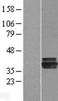 AGMAT Protein - Western validation with an anti-DDK antibody * L: Control HEK293 lysate R: Over-expression lysate
