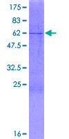 AGMAT Protein - 12.5% SDS-PAGE of human AGMAT stained with Coomassie Blue