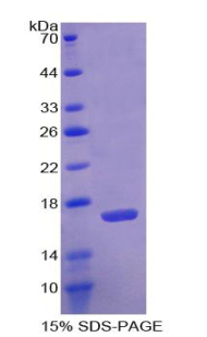 AGMAT Protein - Recombinant Agmatine Ureohydrolase By SDS-PAGE