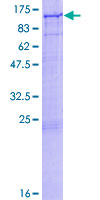 AGO1 / EIF2C Protein - 12.5% SDS-PAGE of human EIF2C1 stained with Coomassie Blue