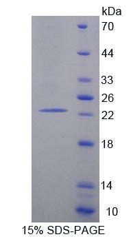 AGO1 / EIF2C Protein - Recombinant Eukaryotic Translation Initiation Factor 2C1 (EIF2C1) by SDS-PAGE