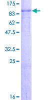 AGO3 / EIF2C3 Protein - 12.5% SDS-PAGE of human EIF2C3 stained with Coomassie Blue