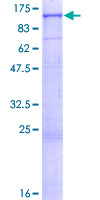 AGO4 / EIF2C4 Protein - 12.5% SDS-PAGE of human EIF2C4 stained with Coomassie Blue
