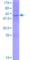 AGPAT1 Protein - 12.5% SDS-PAGE of human AGPAT1 stained with Coomassie Blue