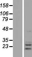 AGPAT2 Protein - Western validation with an anti-DDK antibody * L: Control HEK293 lysate R: Over-expression lysate