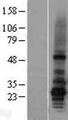 AGPAT2 Protein - Western validation with an anti-DDK antibody * L: Control HEK293 lysate R: Over-expression lysate