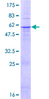 AGPAT2 Protein - 12.5% SDS-PAGE of human AGPAT2 stained with Coomassie Blue
