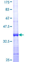 AGPAT3 Protein - 12.5% SDS-PAGE Stained with Coomassie Blue.